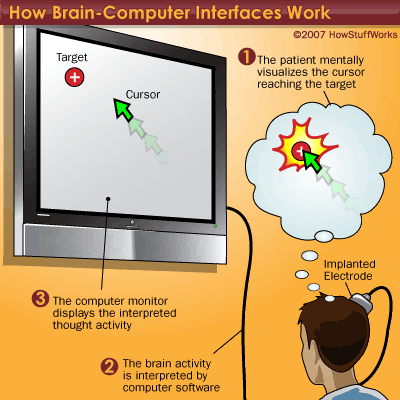 internet brains